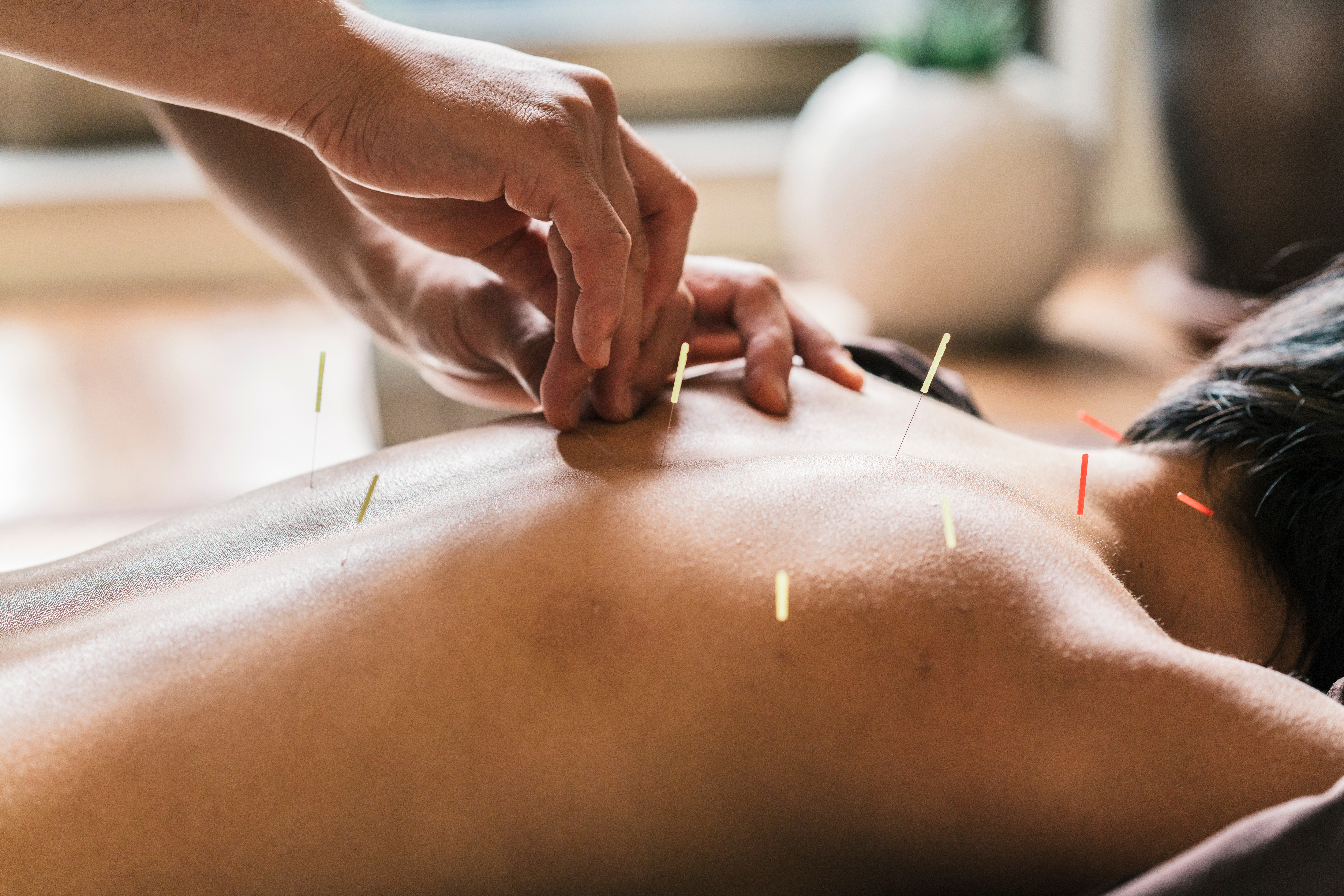 L’acupuncture peut-elle être un traitement de l’incontinence ?